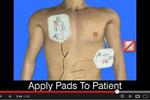 Preparing the patient for AED use